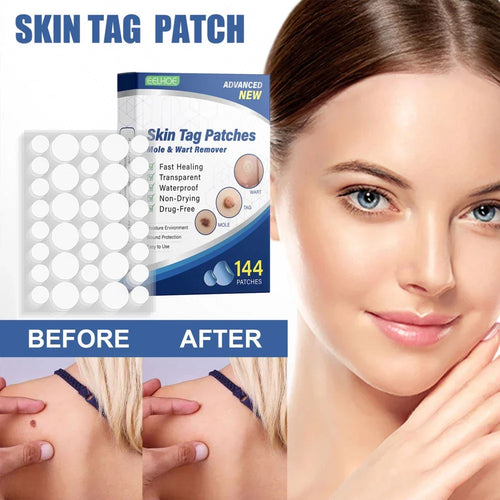 EELHOE Skin Tag Patch Mole and Wart Remover Herbal Extract Invisible Warts Stickers 144pcs