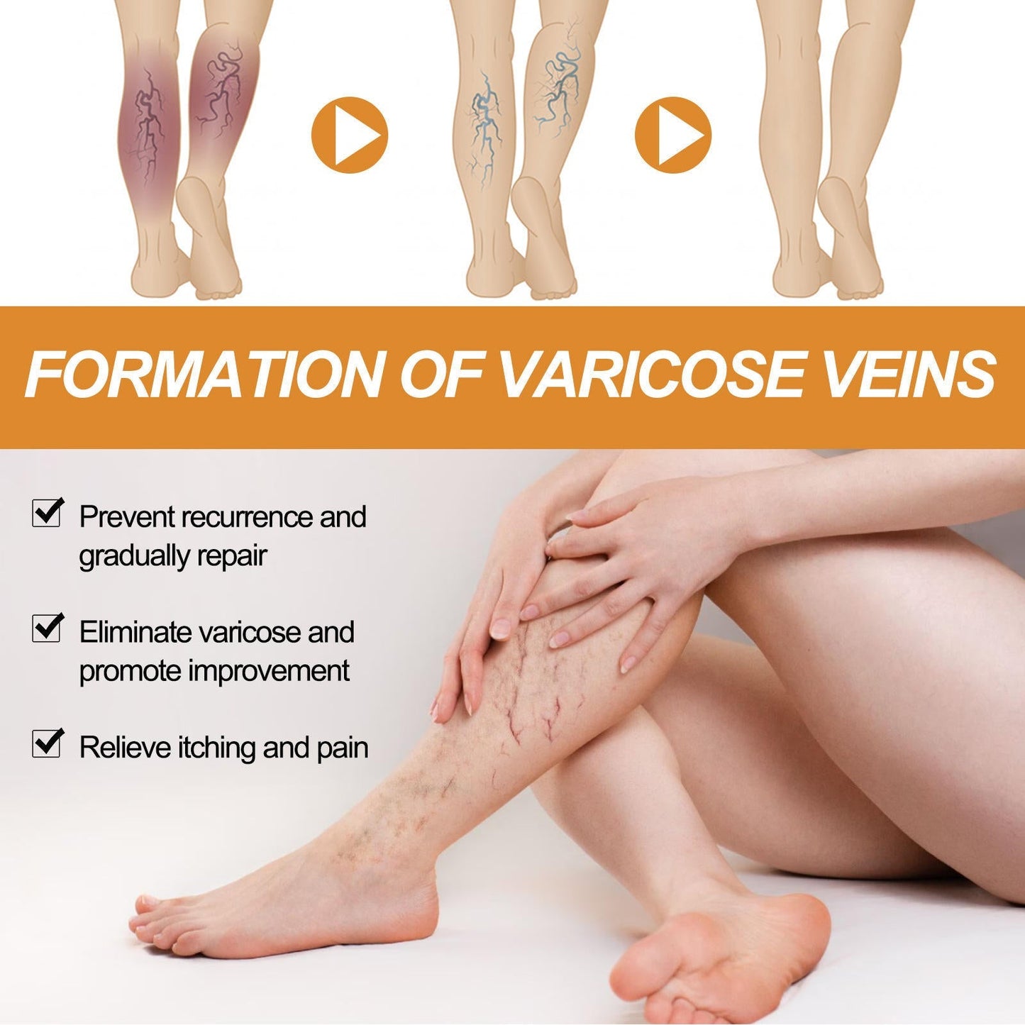 Turmeric Varicose Vein Relief Spray( BUY 1 GET 2 FREE💥 🎁  )