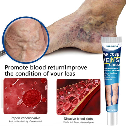 Sol Lora Varicose veins Cream (BUY 1 GET 1 FREE)