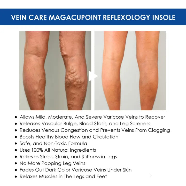 Oveallgo™ VeinCare MagAcupoint Reflexology Insole ( BUY 1 GET 1 FREE )