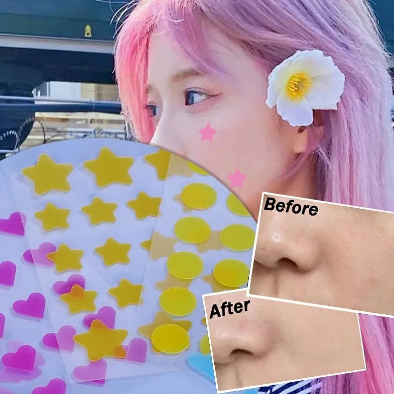 Premium Star Shaped Pimple Patches Pack Of 200