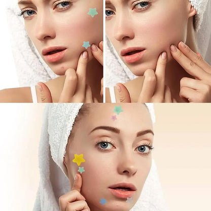 Premium Star Shaped Pimple Patches Pack Of 200