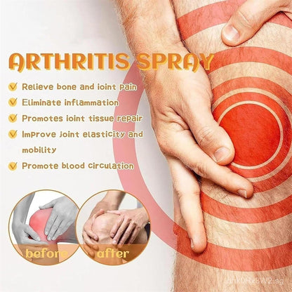 Ximonth Bee Venom Joints Pain Relief Spray(BUY 1 GET 1 FREE)